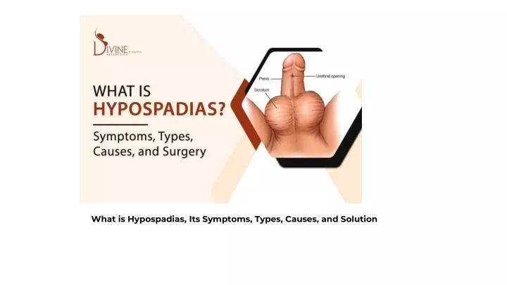 what is hypospadias its symptoms types causes and solution