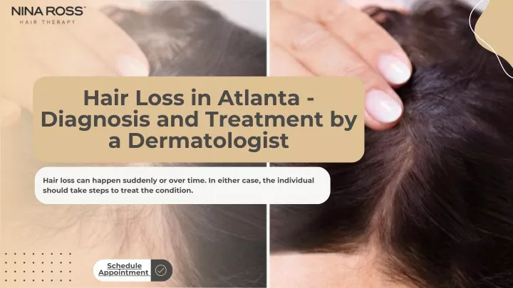 hair loss in atlanta diagnosis and treatment