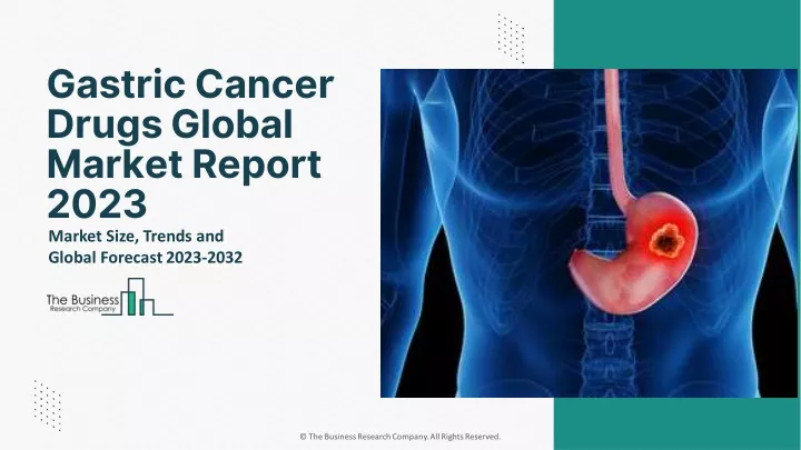 gastric cancer drugs global market report 2023