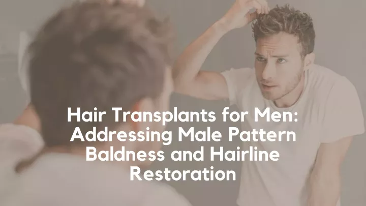 hair transplants for men addressing male pattern