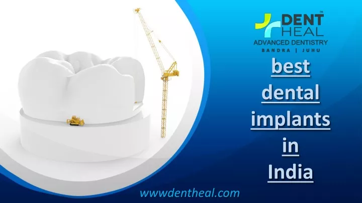best dental implants in india