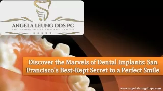 Discover the Marvels of Dental Implants San Francisco’s Best-Kept Secret to a Perfect Smile