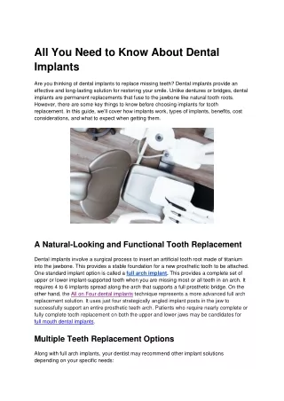 All You Need to Know About Dental Implants