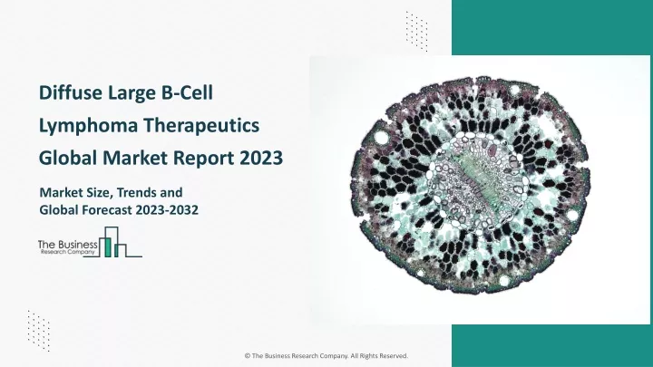 diffuse large b cell lymphoma therapeutics global