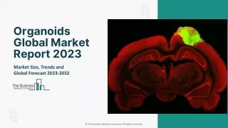 Organoids Market 2023 : Industry Analysis, Growth, Drivers And Forecast 2032