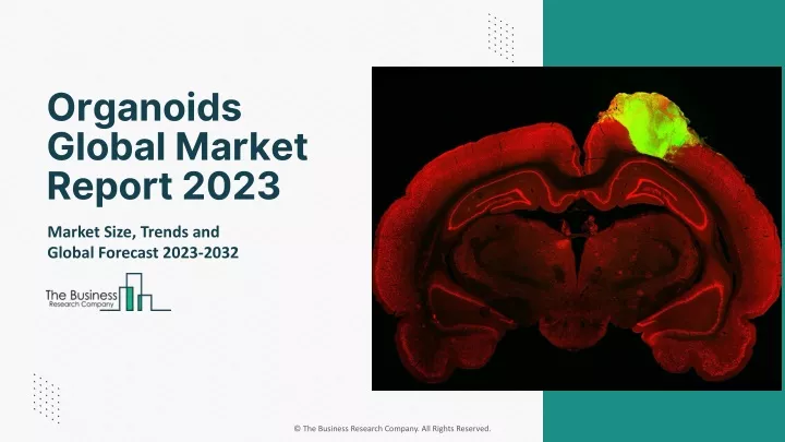 organoids global market report 2023
