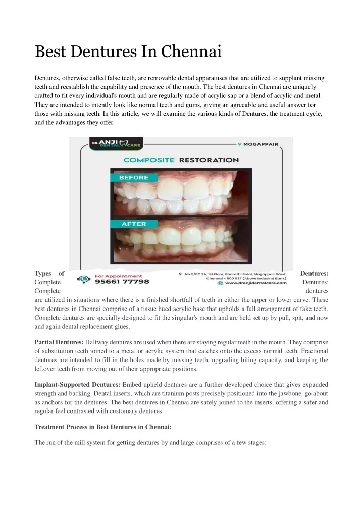 best dentures in chennai dentures otherwise