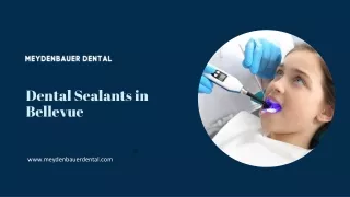 Dental Sealants in Bellevue - Protecting Your Smile