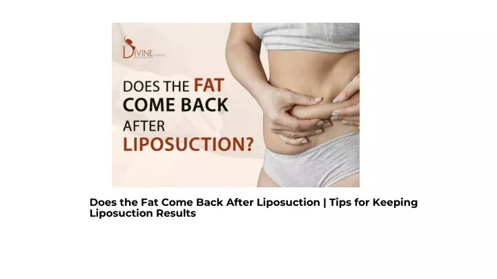 does the fat come back after liposuction tips for keeping liposuction results