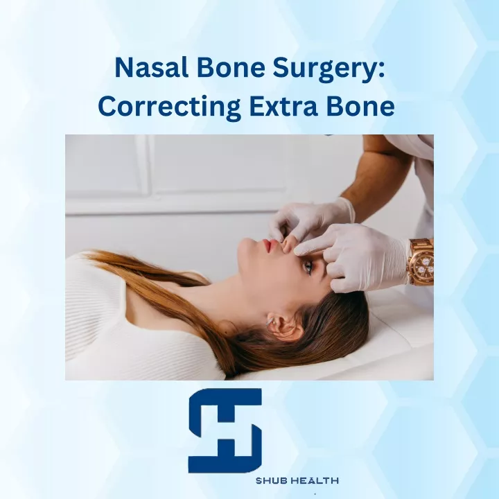 nasal bone surgery correcting extra bone