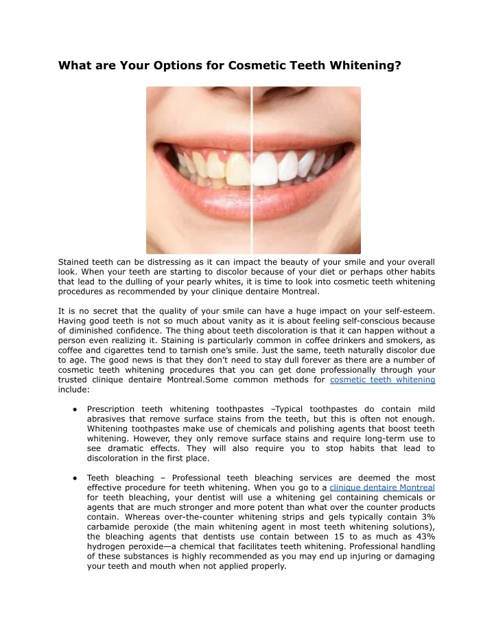 what are your options for cosmetic teeth whitening