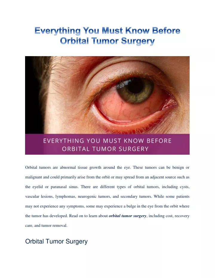 orbital tumors are abnormal tissue growth around