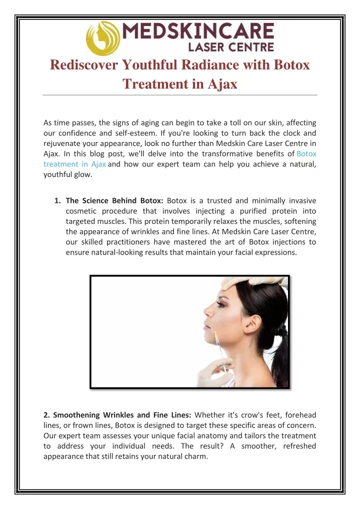 rediscover youthful radiance with botox treatment