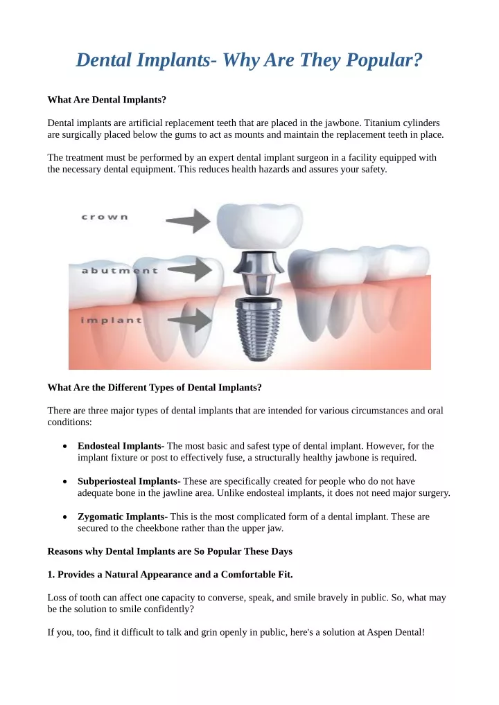 dental implants why are they popular