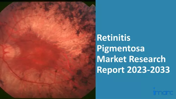 retinitis pigmentosa market research report 2023 2033