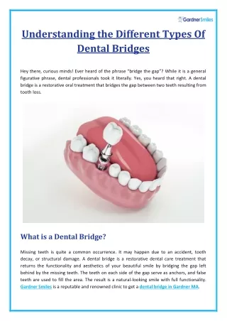 What are the Different types of Dental Bridges?