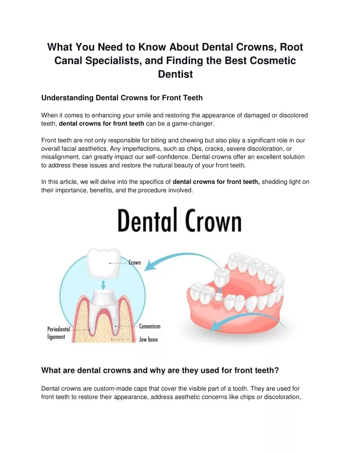 what you need to know about dental crowns root