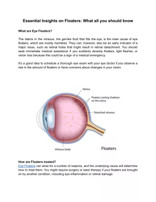 Effective Treatment for Eye Floaters at Goyal Eye
