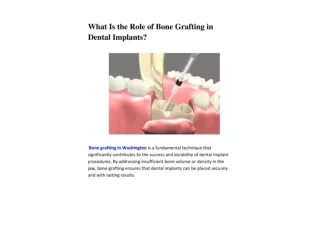 What Is the Role of Bone Grafting in Dental Implants?