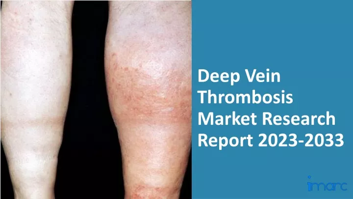 deep vein thrombosis market research report 2023 2033