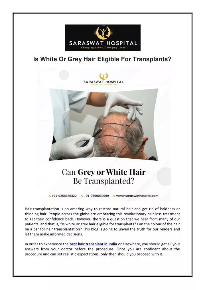 is white or grey hair eligible for transplants
