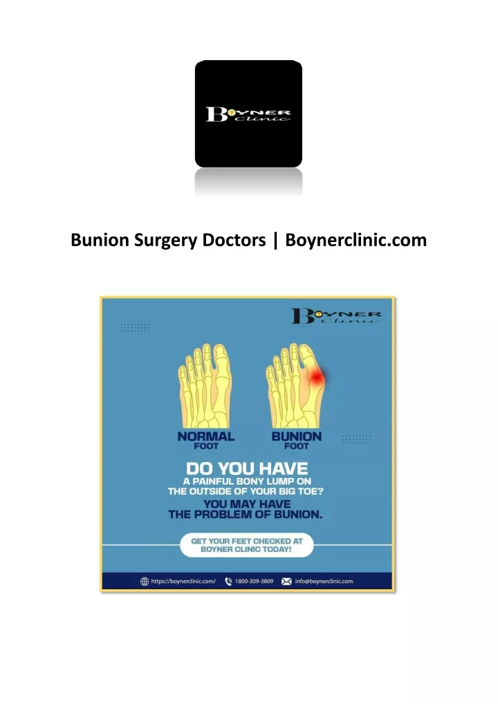 bunion surgery doctors boynerclinic com