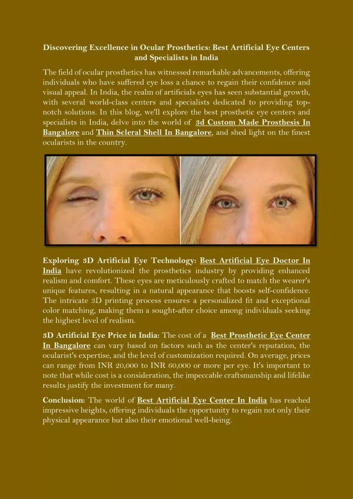 discovering excellence in ocular prosthetics best