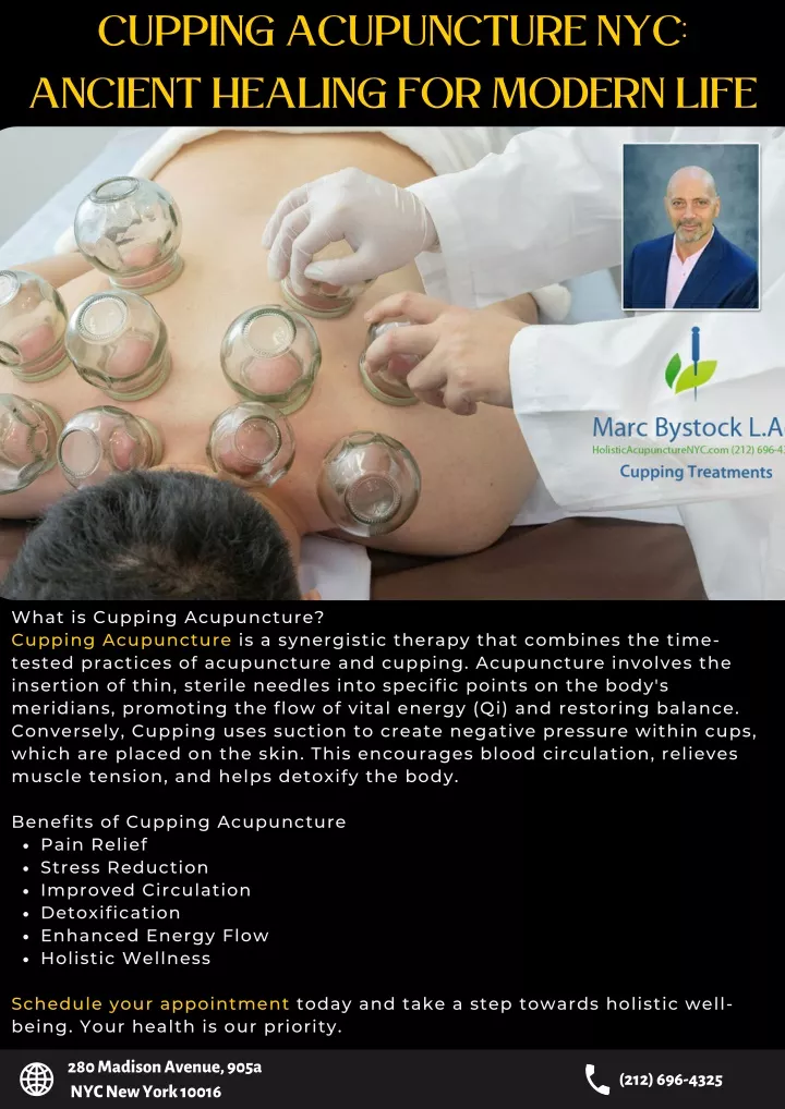 cupping acupuncture nyc ancient healing