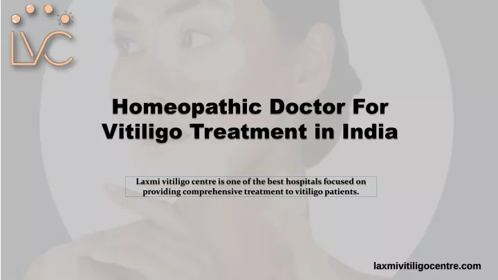 homeopathic doctor for vitiligo treatment in india