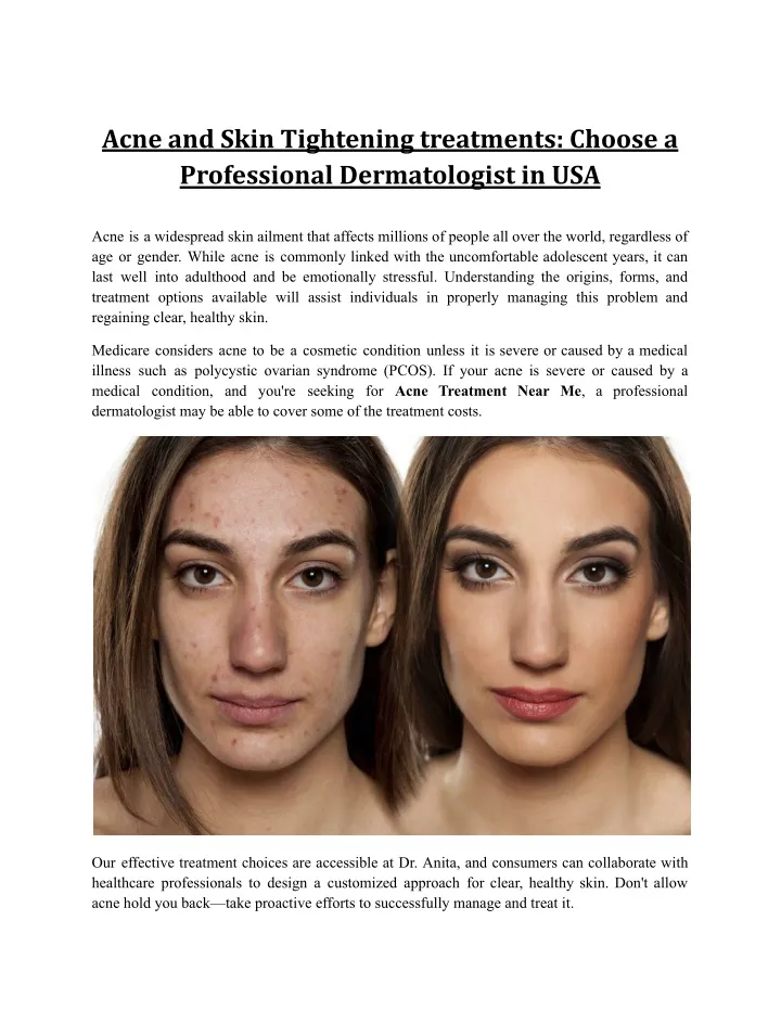 acne and skin tightening treatments choose