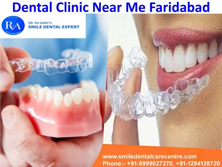 dental clinic near me faridabad