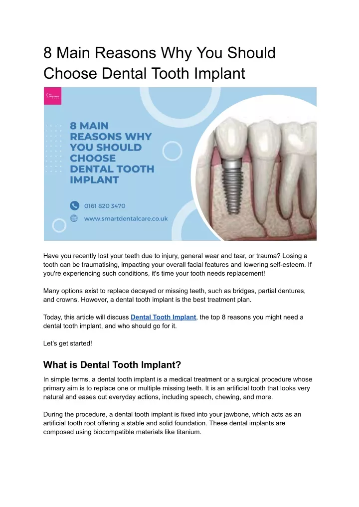 8 main reasons why you should choose dental tooth
