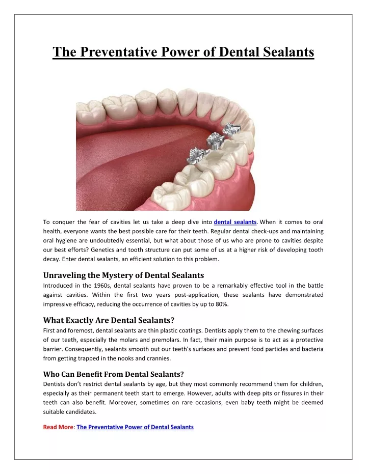 the preventative power of dental sealants