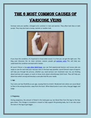 The 6 Most Common Causes of Varicose Veins