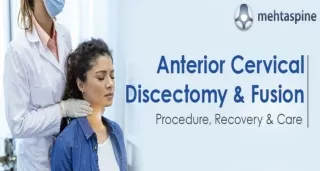 Anterior Cervical Discectomy and Fusion (ACDF) Procedure : Recovery and Care |Me