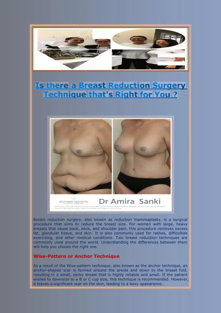 breast reduction surgery also known as reduction