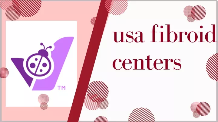 usa fibroid centers