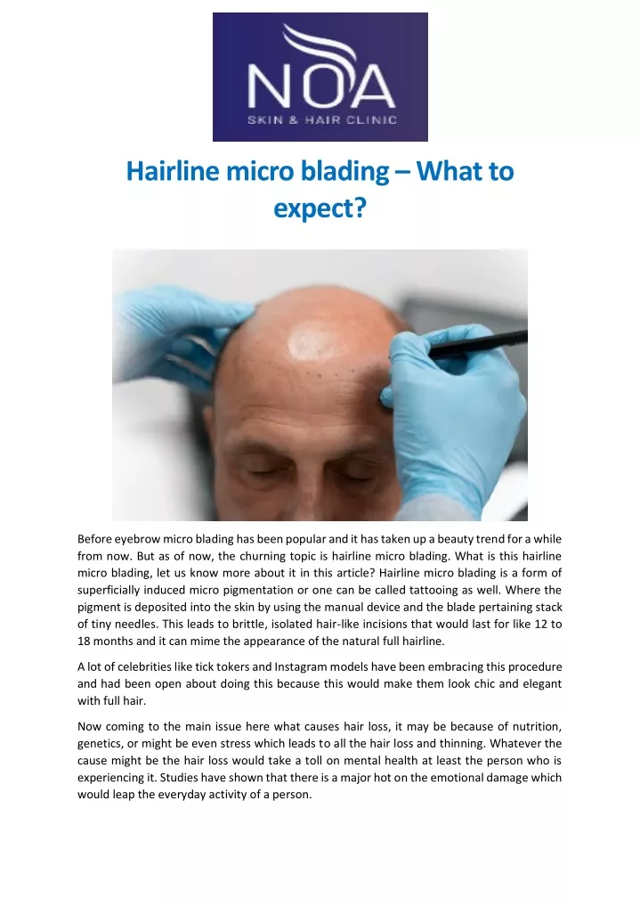 hairline micro blading what to expect