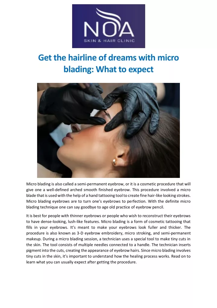 get the hairline of dreams with micro blading