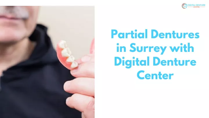 partial dentures in surrey with digital denture