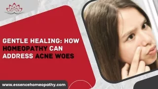 Gentle Healing: How Homeopathy Can Address Acne Woes