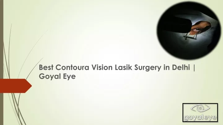 best contoura vision lasik surgery in delhi goyal eye