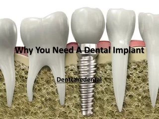 Why You Need A Dental Implant