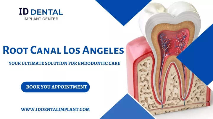 root canal los angeles