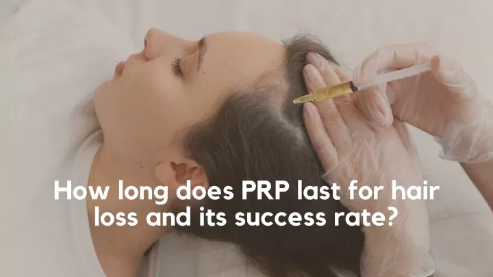 how long does prp last for hair loss