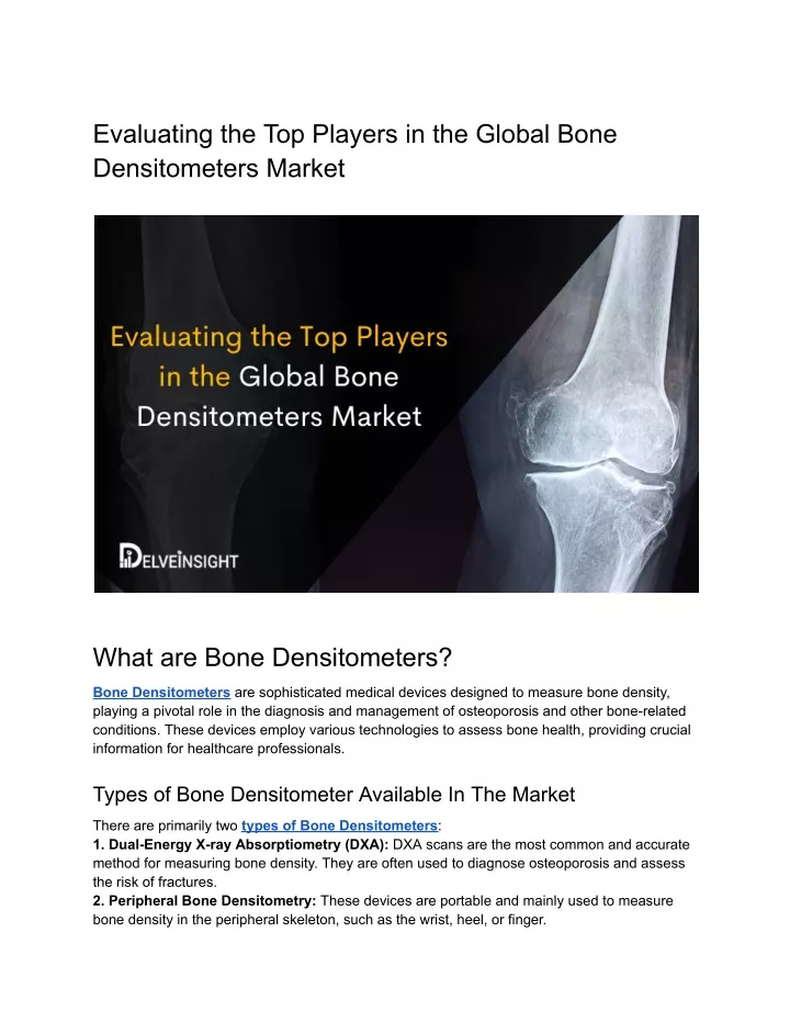 evaluating the top players in the global bone