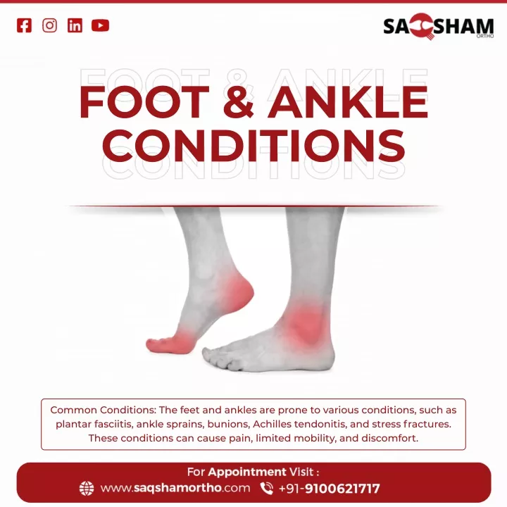 foot ankle conditions