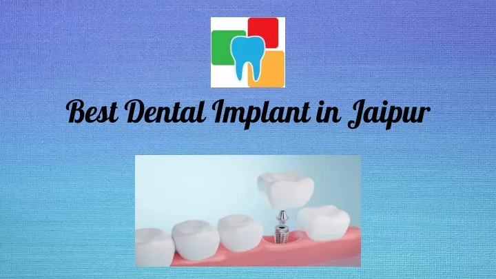 best dental implant in jaipur