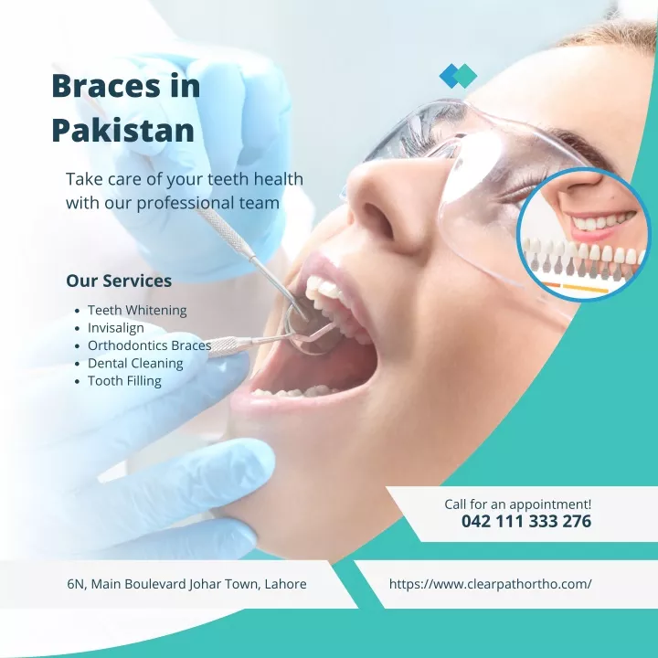 braces in pakistan