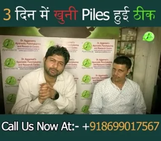 3 दिन में खुनी Piles हुई ठीक